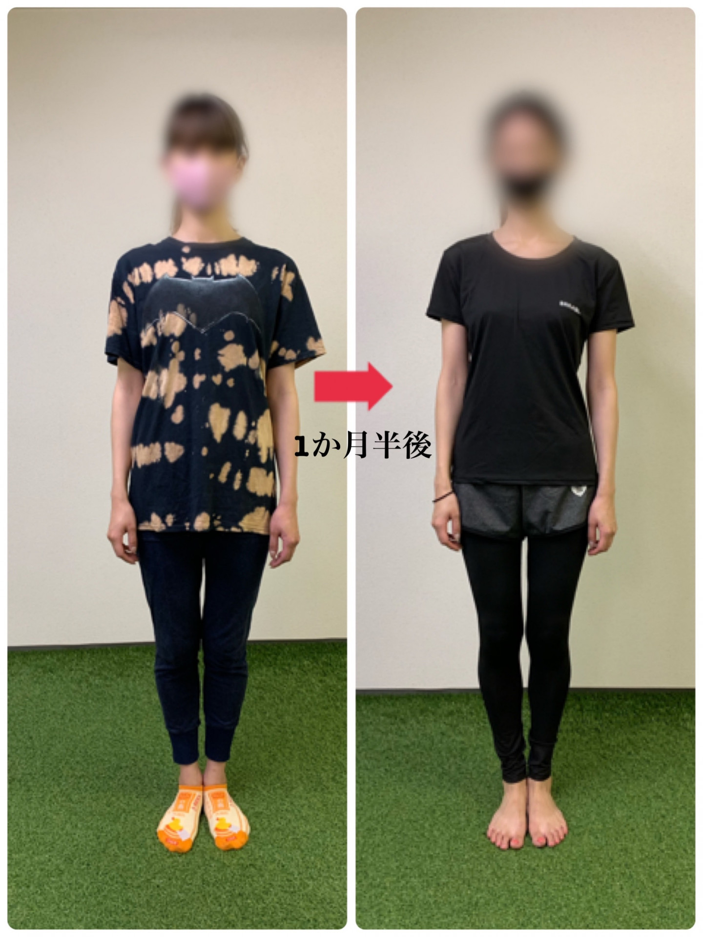 【お客様ご紹介】２０代女性　モデル業